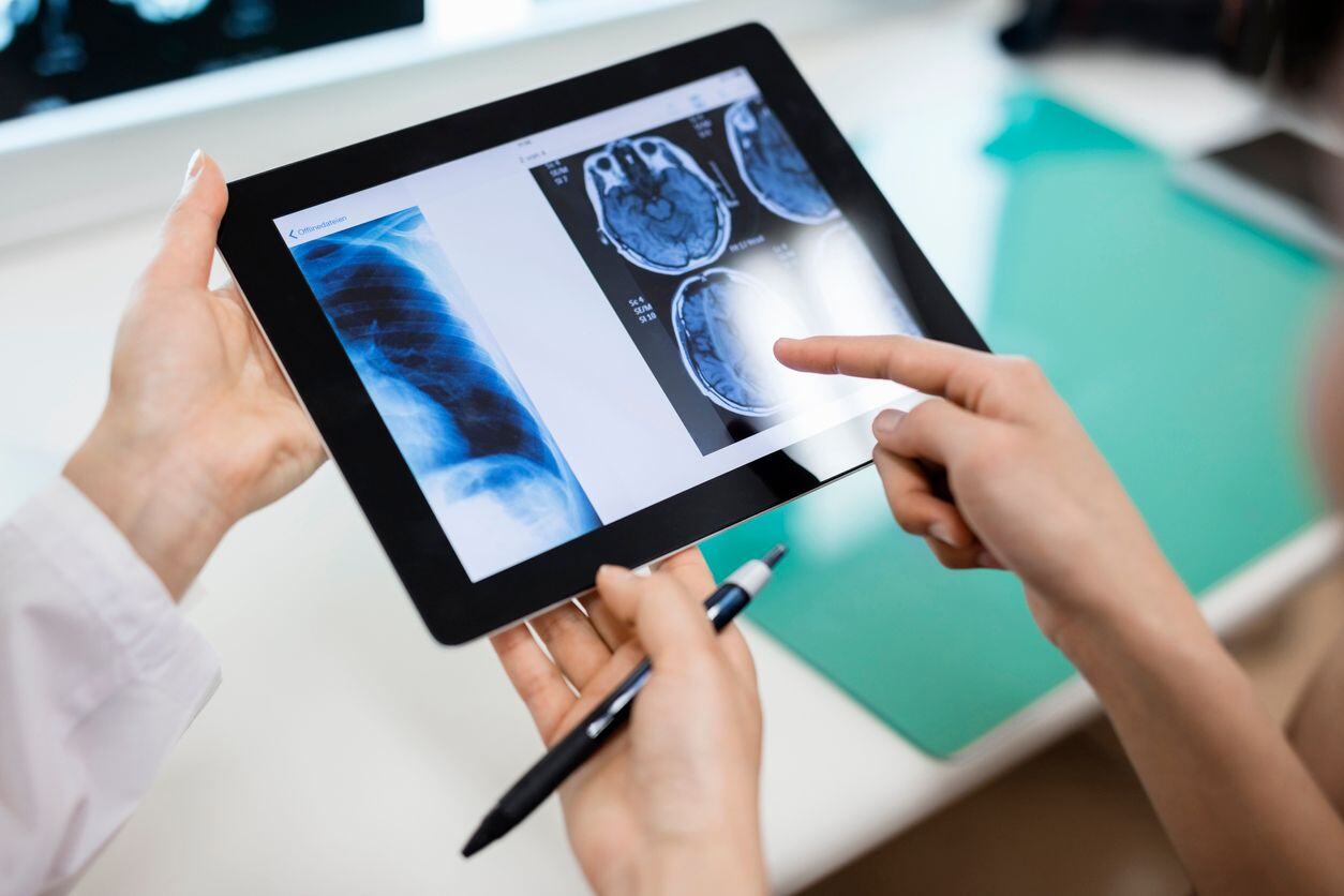 PACS What It Is and How It Works Together With Radiology Information